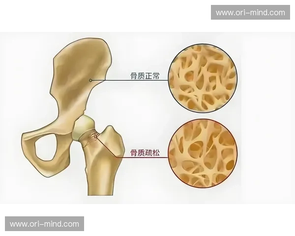 骨骼强度与健康关系探讨：影响因素、评估方法及提升策略分析